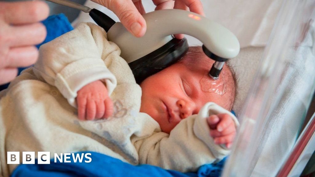 Multiple failures in Scotland's audiology services, report finds