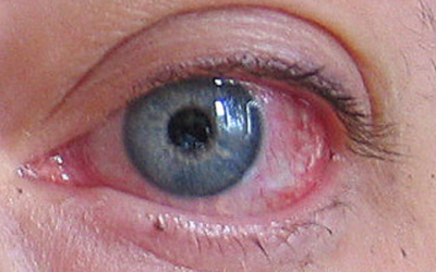 Ailments Breast Milk Has Been Said To Relieve