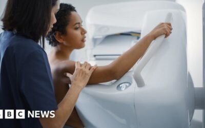 Cancer waiting times in 2023 worst on record