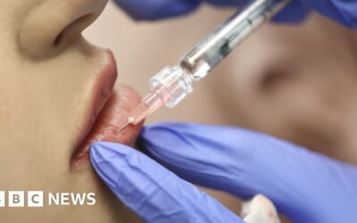 Plans to ban unlicensed Botox providers in England made public