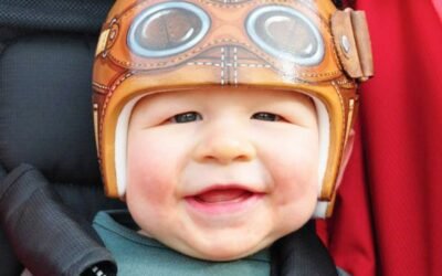 Helmet Therapy For Baby: A Parents’ Guide