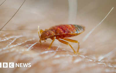 Why do we itch when reading about bedbugs?