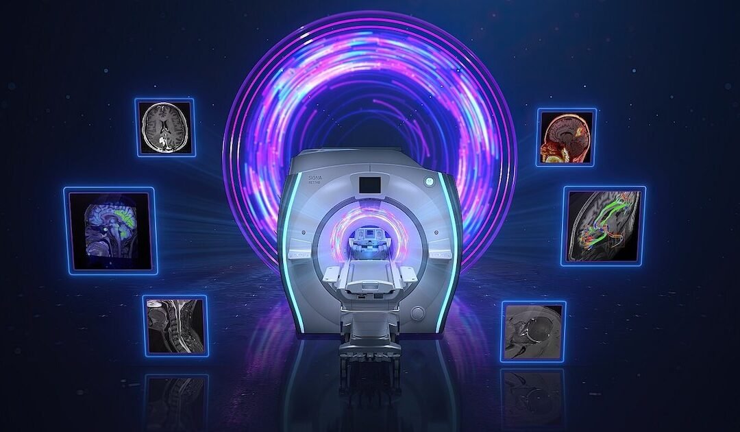 RSNA23: GE HealthCare leverages AI, data integration for patient care