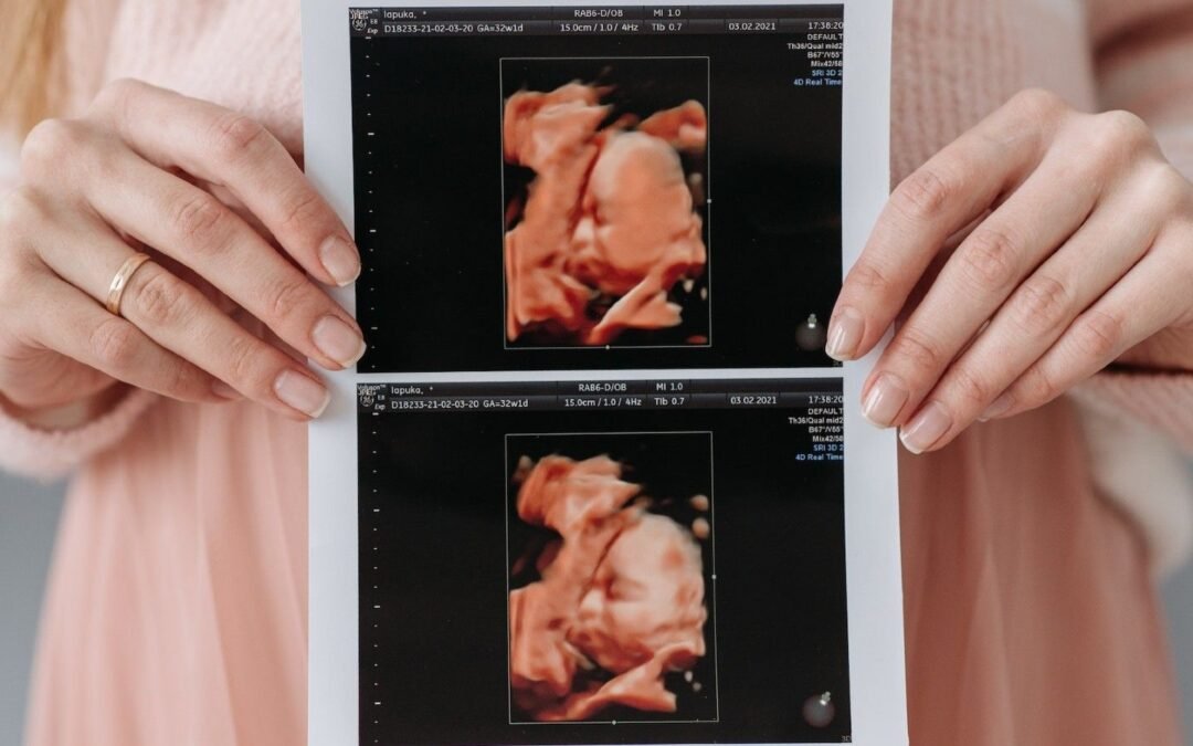 Signs Baby Is Healthy In Utero