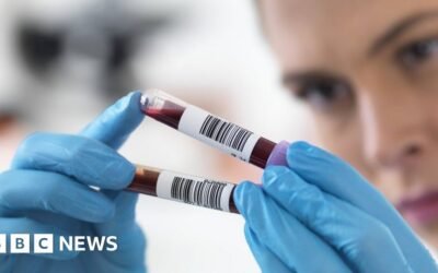 Blood test shows if organs are ageing fast or slowly