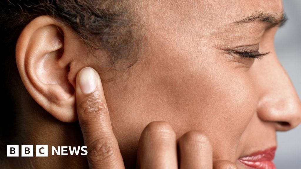 Millions lose access to free NHS earwax removal