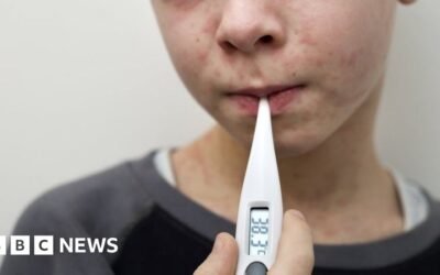 Why are measles cases rising and what is the MMR vaccine?