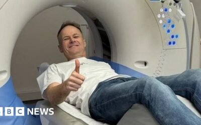 Richard Scolyer: Melanoma doctor’s high-stakes gamble to treat his brain cancer