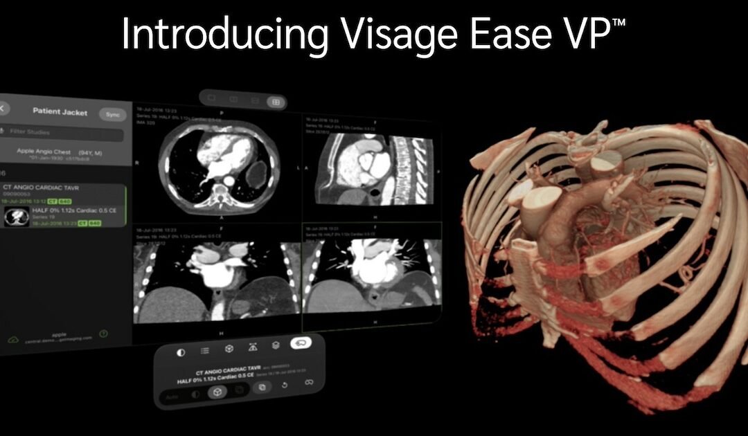 Visage Imaging launches diagnostic imaging platform for Apple Vision Pro